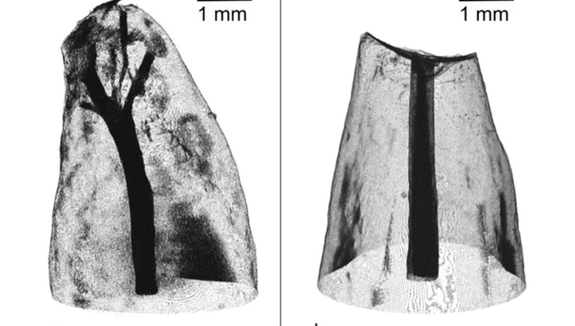 imagescience-blog-ct-images-1200x800-11